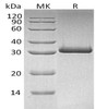 Human MBL2/MBL/COLEC1 Recombinant Protein (RPES4255)