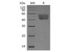 Rat PD-L1 Recombinant Protein (C-His) (RPES4268)