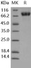 Human ICAM-2/CD102 Recombinant Protein (His & Fc Tag) (Active) (RPES4272)