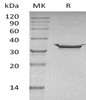 Carbonic Anhydrase 5B/CA5B Recombinant Protein (RPES4278)