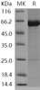 Human KEAP1/INRF2 Recombinant Protein (RPES4295)