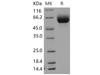 Mouse SLC3A2/CD98 Recombinant Protein (His Tag) (RPES4298)