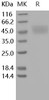 Human Kallikrein 1/KLK1 Recombinant Protein (RPES4301)