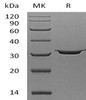 Carbonic Anhydrase 7/CA7 Recombinant Protein (RPES4302)
