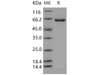 Human CROT Recombinant Protein (474 Leu/Val, His Tag) (RPES4320)