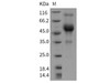 Rat CD83/HB15 Recombinant Protein (Fc Tag) (RPES4322)