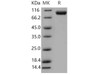 Mouse VCAM1 Recombinant Protein (RPES4324)