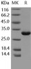 Human MBL2/MBL/COLEC1 Recombinant Protein (RPES4326)