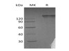Human Semaphorin 4D/SEMA4D Recombinant Protein (RPES4330)