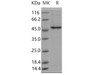 Mouse GSK3B Recombinant Protein (His Tag) (Active) (RPES4332)