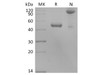 Human BLyS/TNFSF13B/BAFF Recombinant Protein (RPES4340)