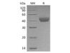 Rat CD38 Recombinant Protein (RPES4342)