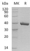 Human CA11 Recombinant Protein (RPES4351)