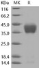 Mouse ASGPR1/ASGR1 Recombinant Protein (His Tag) (RPES4356)