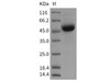 Rat CD79B/B29 Recombinant Protein (Fc Tag) (RPES4371)