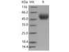 Mouse PLAUR/uPAR Recombinant Protein (His Tag) (Active) (RPES4396)