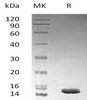 Human LAMTOR3/MP1 Recombinant Protein (RPES4401)