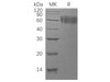Human DR6/TNFRSF21 Recombinant Protein (RPES4410)
