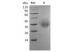 Human BTLA/CD272 Recombinant Protein (RPES4412)