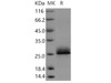 Human Serglycin/SRGN Recombinant Protein (His&Myc Tag) (RPES4413)