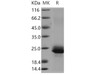 Human Serglycin/SRGN Recombinant Protein (His Tag) (RPES4435)