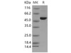 Mouse DOPA Decarboxylase/DDC Recombinant Protein (His Tag) (RPES4439)
