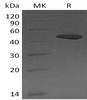 Carboxypeptidase B1/CPB1 Recombinant Protein (RPES4443)