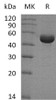 Human SHMT1 Recombinant Protein (RPES4467)