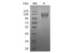 Human CD96 Recombinant Protein (RPES4476)