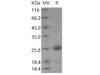 Human BMF/Bcl2 modifying factor Recombinant Protein (His Tag) (RPES4500)