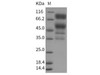 Rat CD55/DAF Recombinant Protein (Fc Tag) (RPES4503)