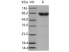 Mouse TNFRSF1B/CD120b Recombinant Protein (Fc Tag) (Active) (RPES4505)