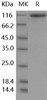 Human ROBO2 Recombinant Protein (His Tag) (RPES4524)