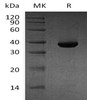 Human MAP1D Recombinant Protein (RPES4531)