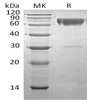 Human SerpinA3/AACT Recombinant Protein (RPES4532)