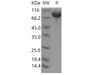 Human DCBLD2/ESDN Recombinant Protein (aa 1-482, His Tag) (RPES4543)