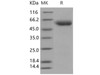 Human SerpinA7/TBG Recombinant Protein (His Tag) (RPES4545)