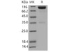 Mouse Axl Kinase Recombinant Protein (His & Fc Tag) (RPES4549)