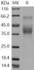 Human SLAMF6/Ly108 Recombinant Protein (aa 1-226, His Tag) (Active) (RPES4564)