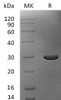 Human Caspase4/CASP14 Recombinant Protein (RPES4571)