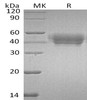 Human SerpinA5/SERPINA5 Recombinant Protein (RPES4574)