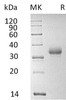 Human CD2 Recombinant Protein (RPES4586)