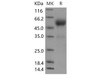 Mouse Frizzled-5/FZD5 Recombinant Protein (RPES4588)