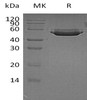 Human Cathepsin A/CTSA Recombinant Protein (RPES4592)