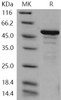 Human ANP32A/PHAP1 Recombinant Protein (His & GST Tag) (RPES4604)