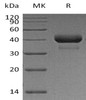 Human Cathepsin B/CTSB Recombinant Protein (RPES4612)