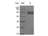 Mouse HVEM/TNFRSF14 Recombinant Protein (RPES4617)
