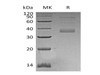 Human MFAP4 Recombinant Protein (RPES4636)