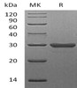 Human Galectin-3/LGALS3 Recombinant Protein  (RPES4654)