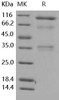 Human HGFA Recombinant Protein (RPES4673)